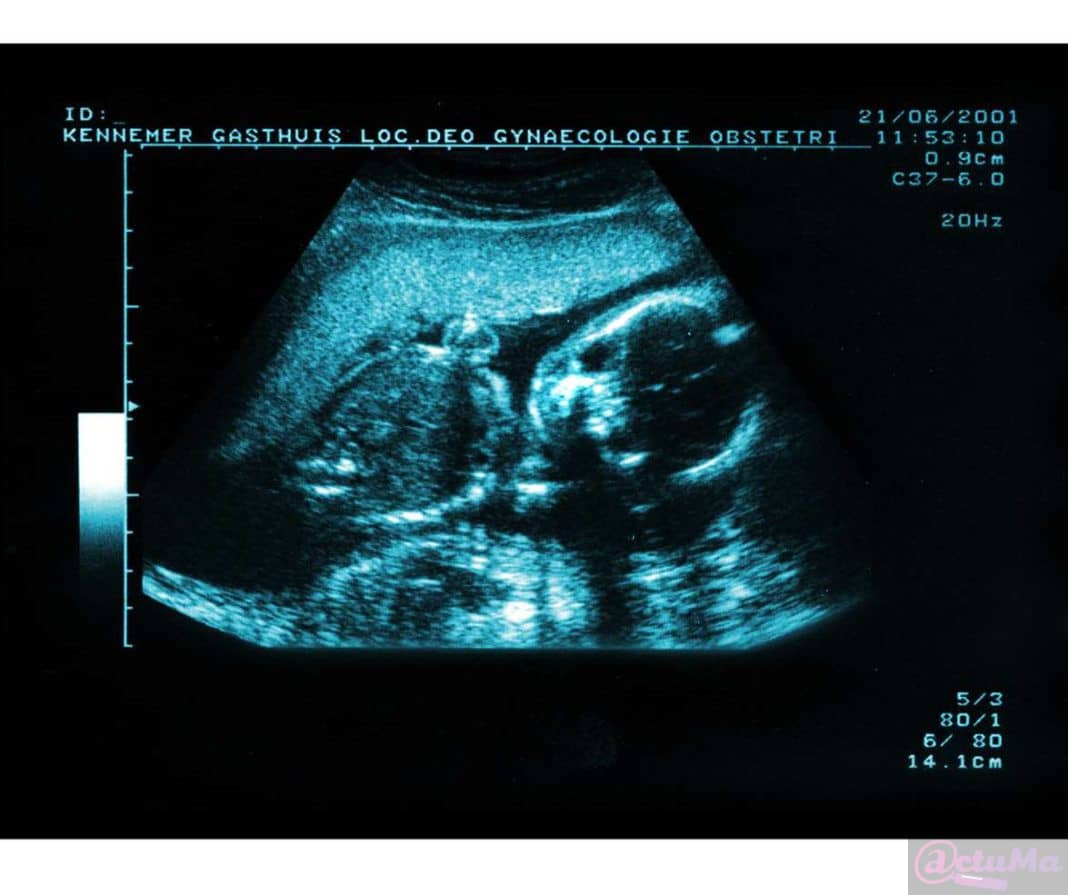 echo baby
